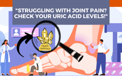 Can high serum uric acid levels be the reason for your arthritis?